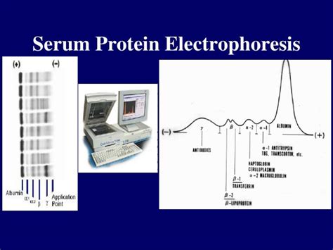 On the Applicability of Electrophoresis for Protein。